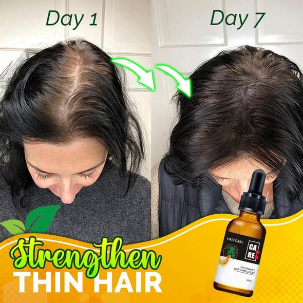 10X-Regro Strong серум за коса