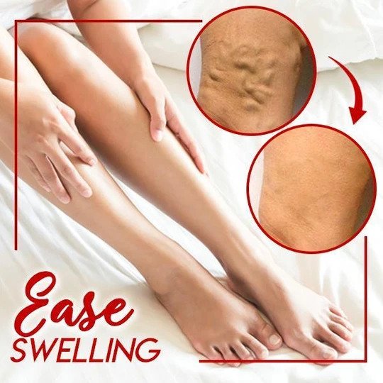 Успокояващ крем LegsRelief - Image 2