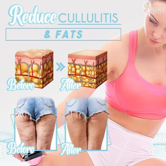 Slimology Детокс масажна топка - Image 3