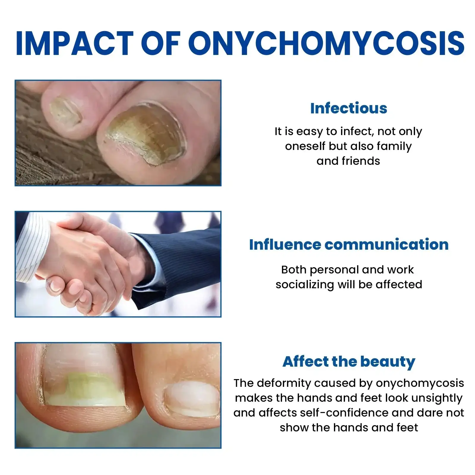 Пластири за възстановяване на гъбички по ноктите - Image 2