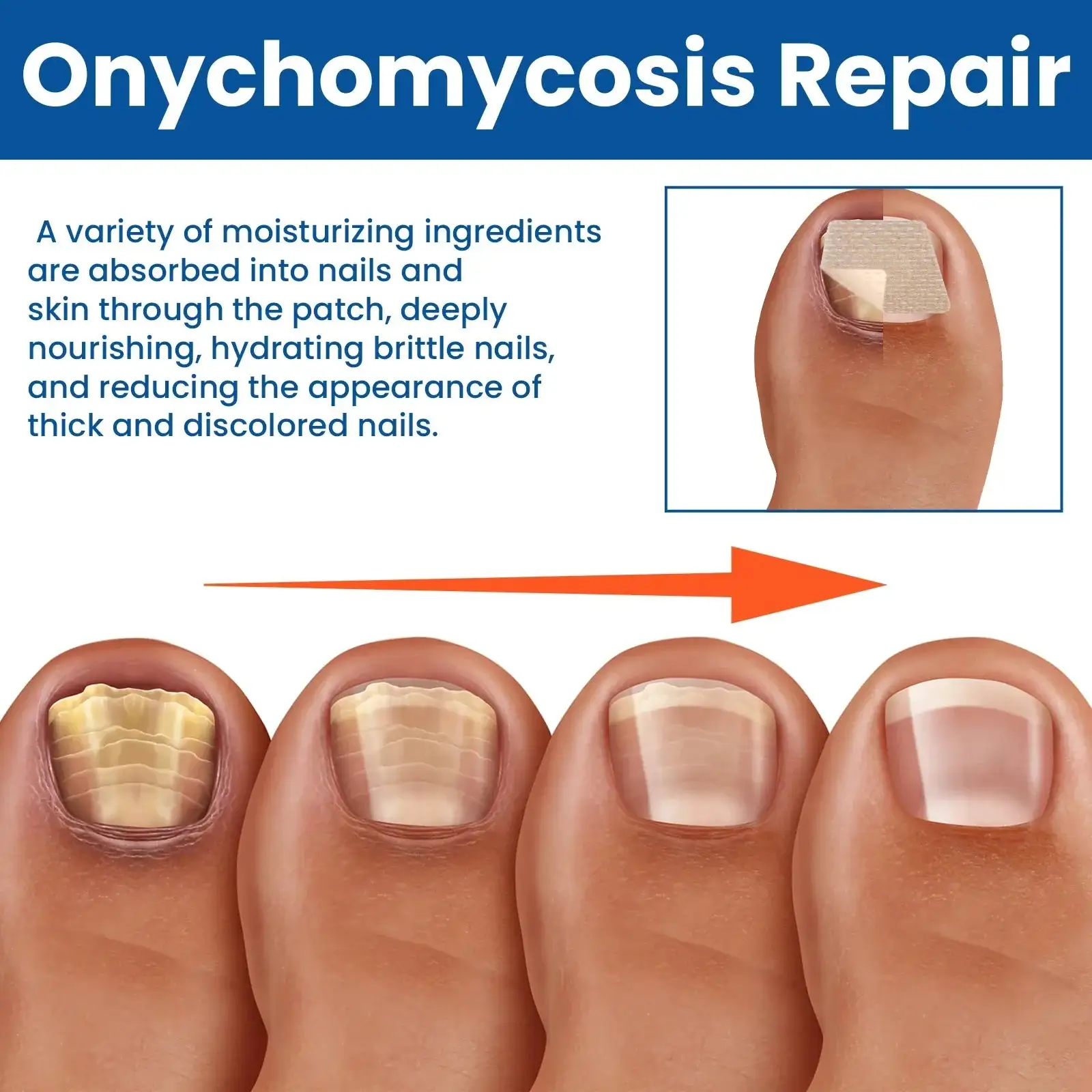Пластири за възстановяване на гъбички по ноктите - Image 4