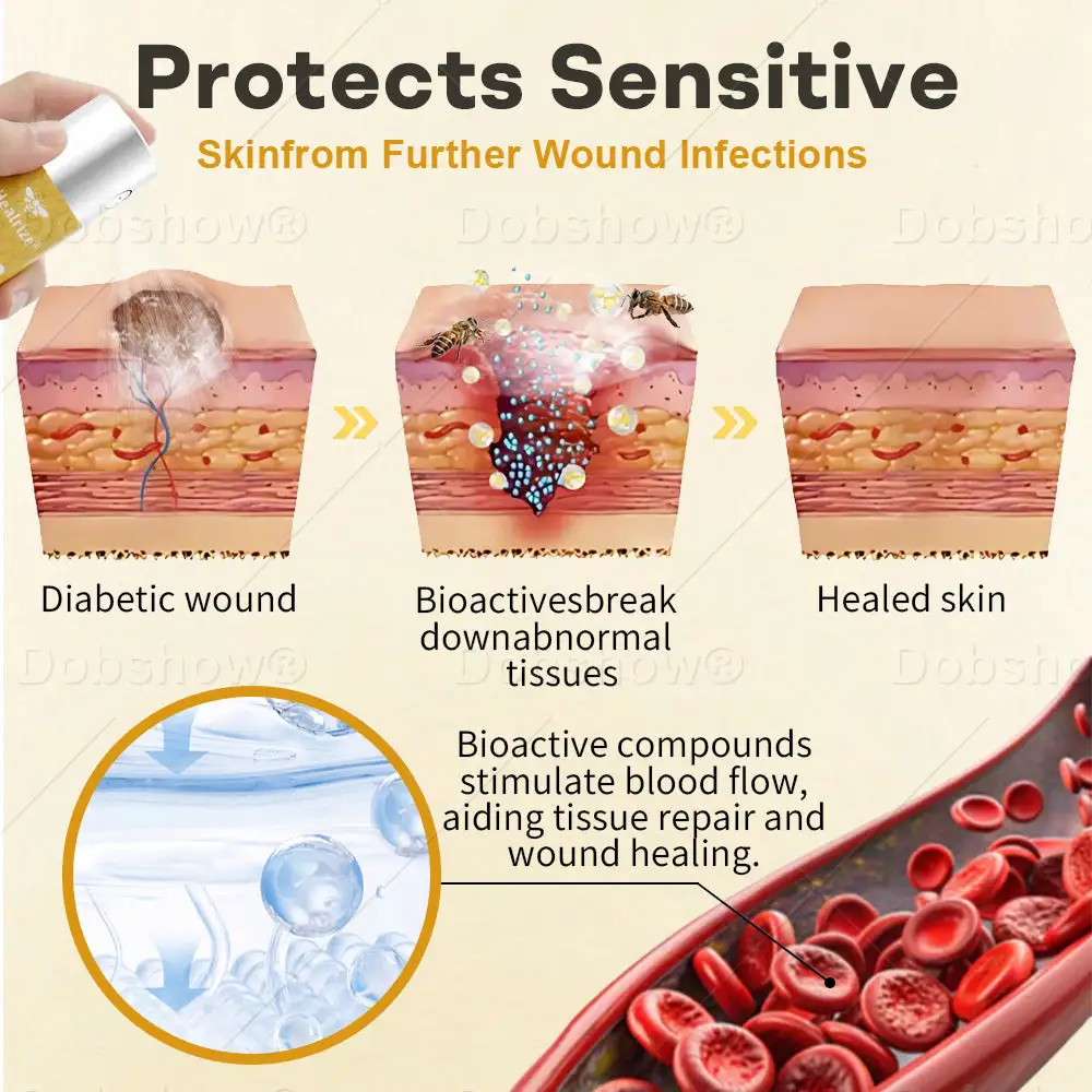 GlucoShield Спрей за рани с пчелна отрова - Image 3