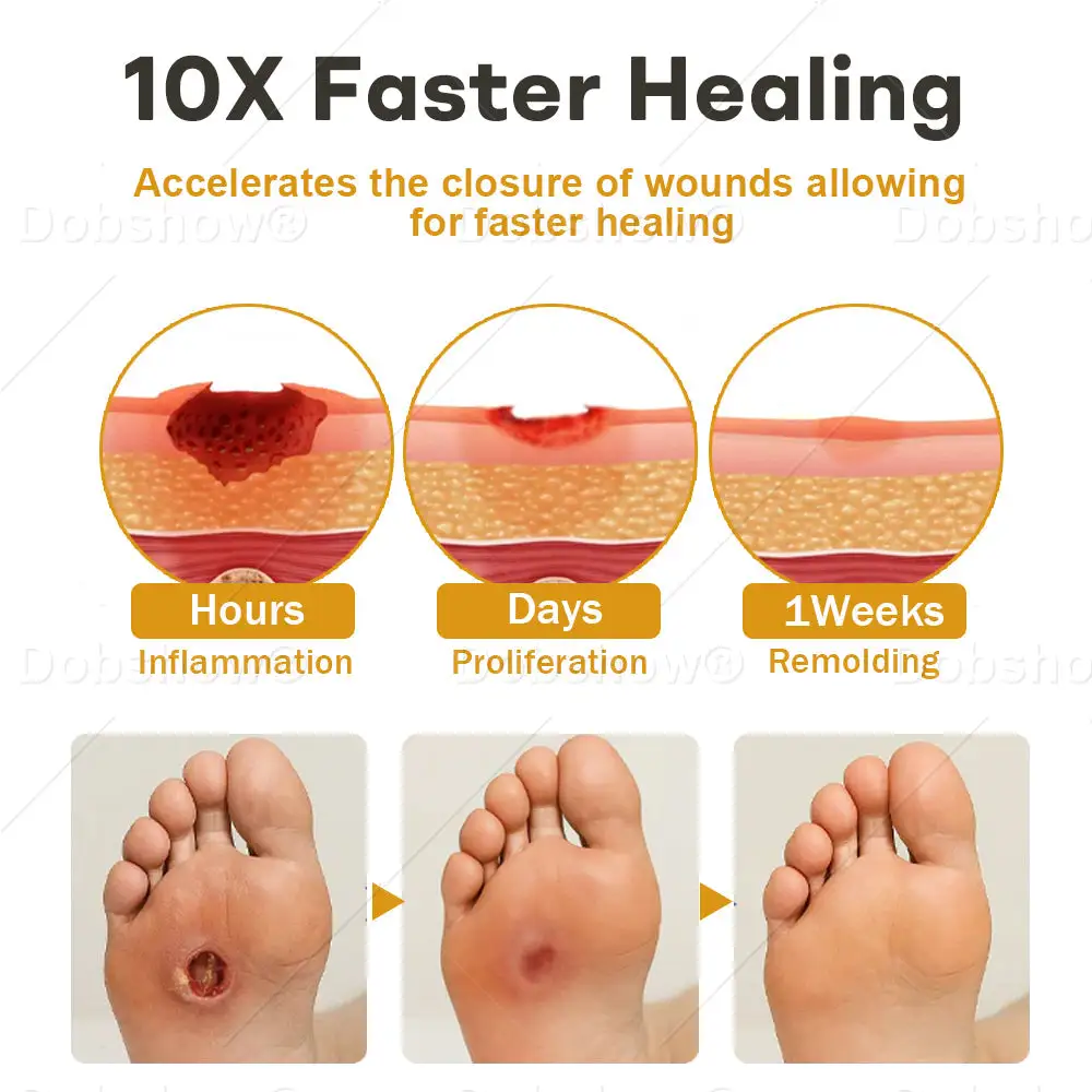 GlucoShield Спрей за рани с пчелна отрова - Image 4