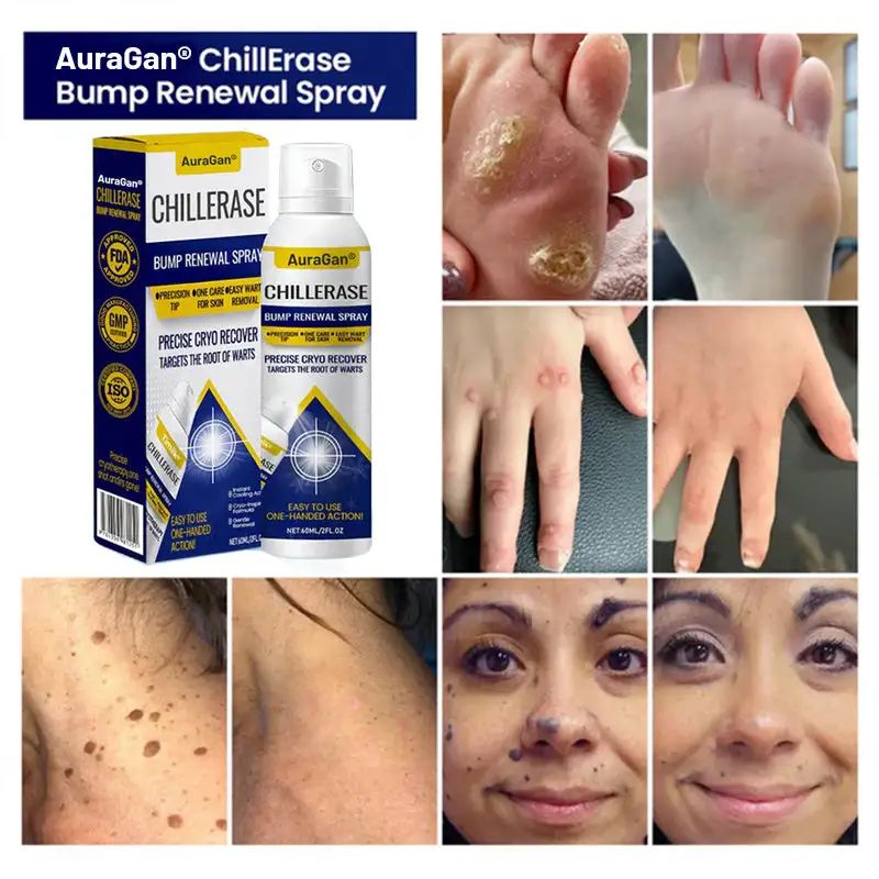 ChillErase Bump Renewal Spray - Image 4