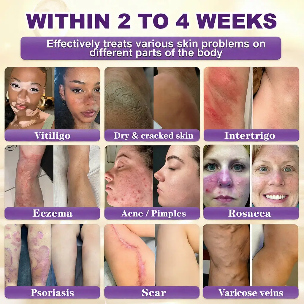 Биотин 10 в 1 крем за възстановяване на кожата - Image 2