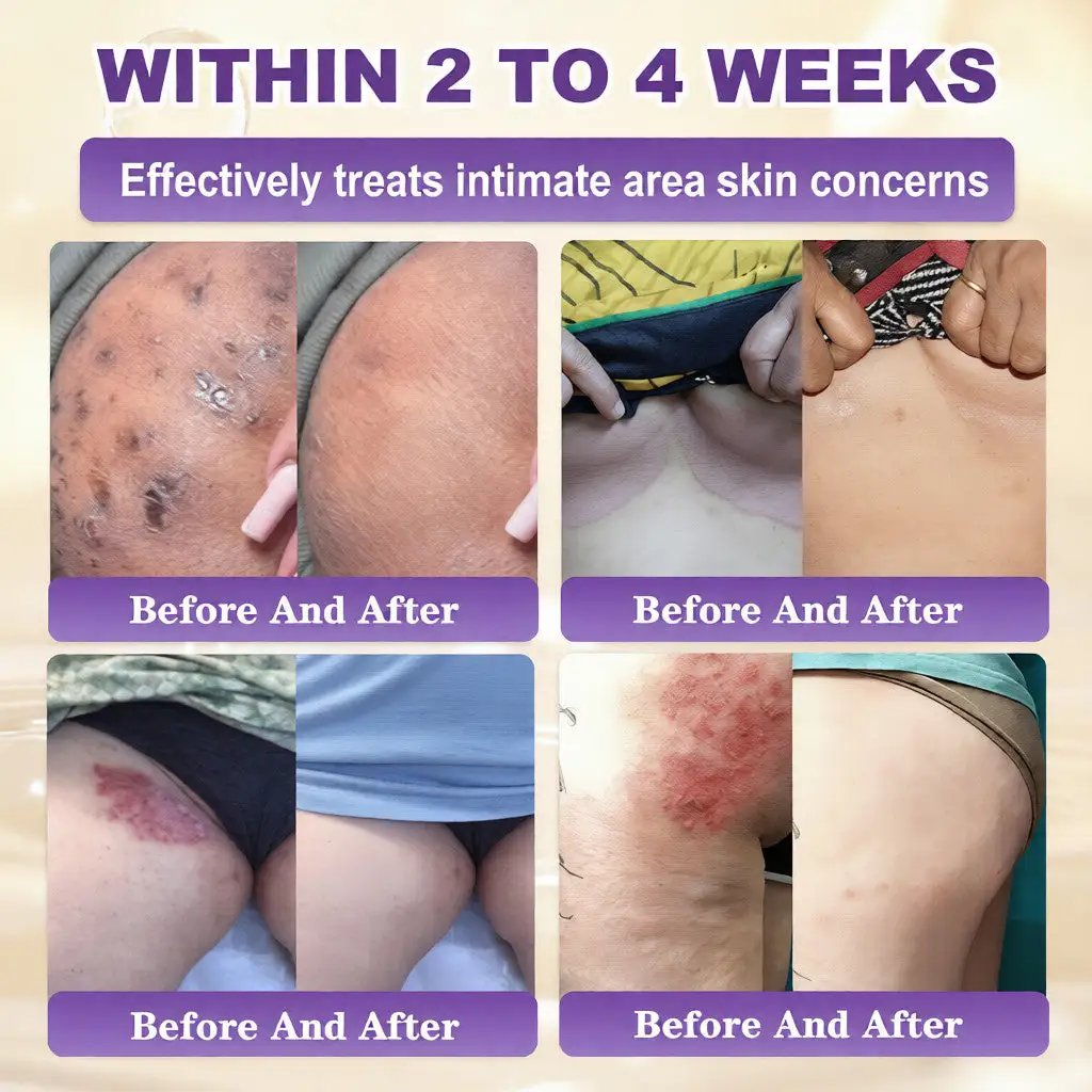 Биотин 10 в 1 крем за възстановяване на кожата - Image 4