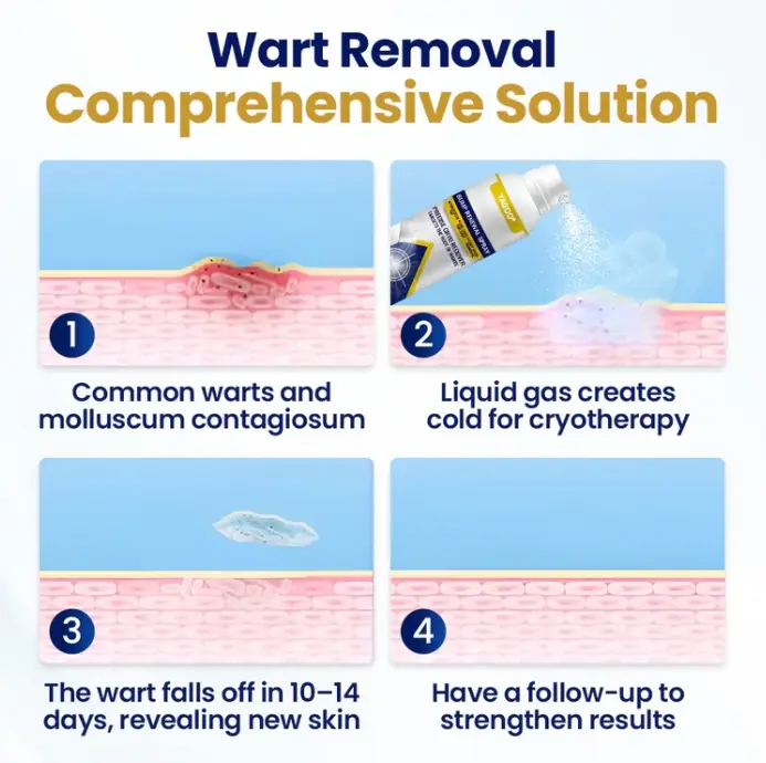 Chillique спрей за подновяване на неравности - Image 3